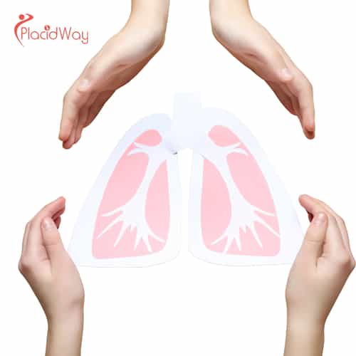 Non-Toxic Lung Cancer Treatment in Tijuana - Breathing Easier Without Chemo Side Effects